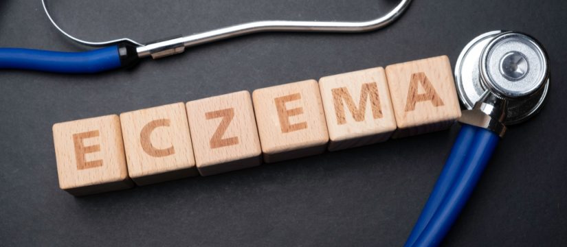 eczema research new treatments