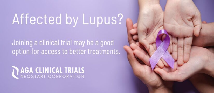 AGA Clinical Trials is seeking lupus patients to participate in a clinical trial offering compensation and free, study-related medical care.
